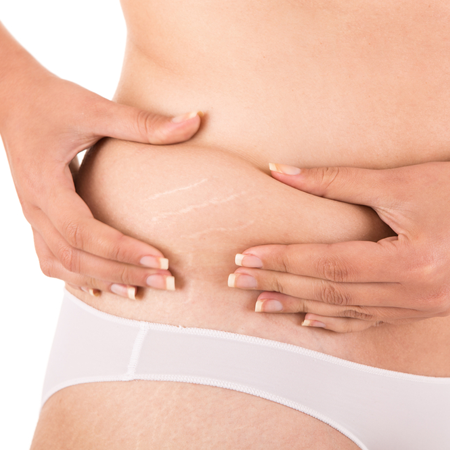Weight loss at All Women's Health Centers (FloridaAbortion.com) abortion clinics in Florida